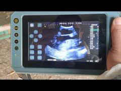 اسکنر سونوگرافی دامپزشکی قابل حمل BR-VET8