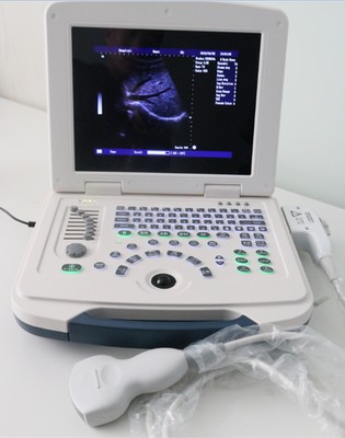 Full-digital laptop Ultrasound Diagnostic System 80element