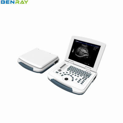 لپ تاپ تمام دیجیتال سیستم تشخیص اولتراسوند 96 عنصر